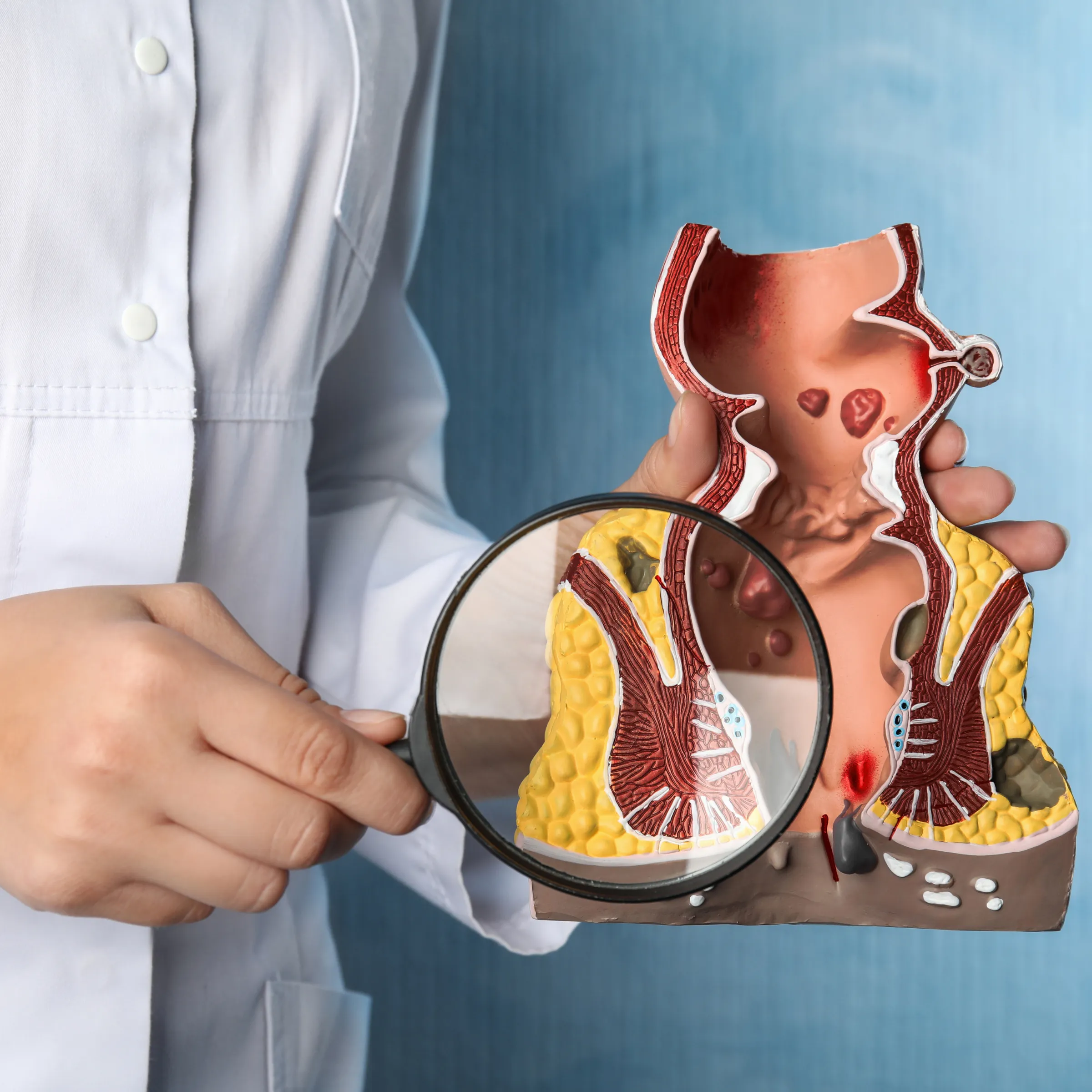 Best Piles, Fissure & Fistula Treatment in Old Sangvi